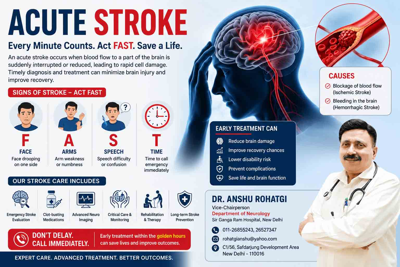 Acute Stroke Treatment in Delhi  