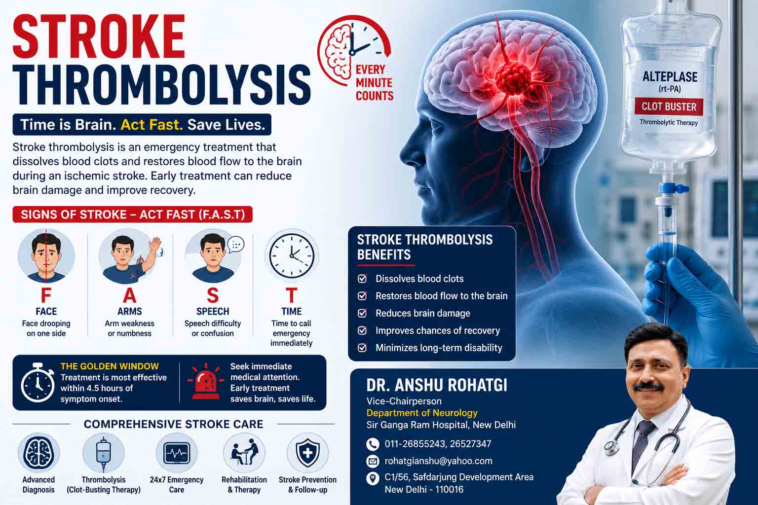 Acute Stroke Treatment in Delhi  